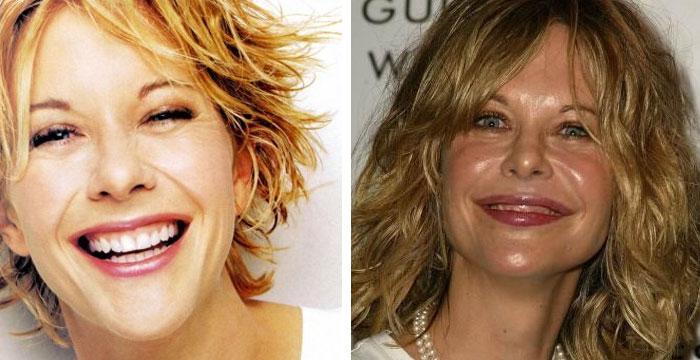 meg-ryan