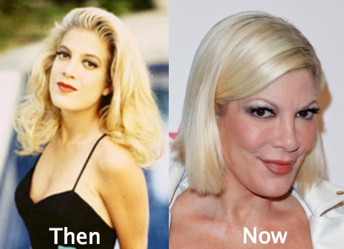 tori-spelling-plastic-surgery-before-and-after