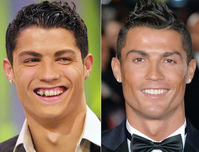 cristianoantesydespues