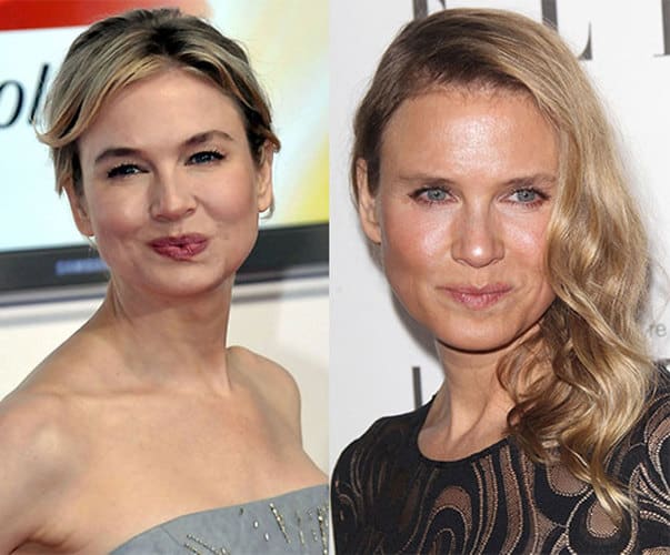 renee-zellweger-before-and-after