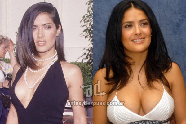 salma-hayek_breast-augmentation_antesydespues-com-ar