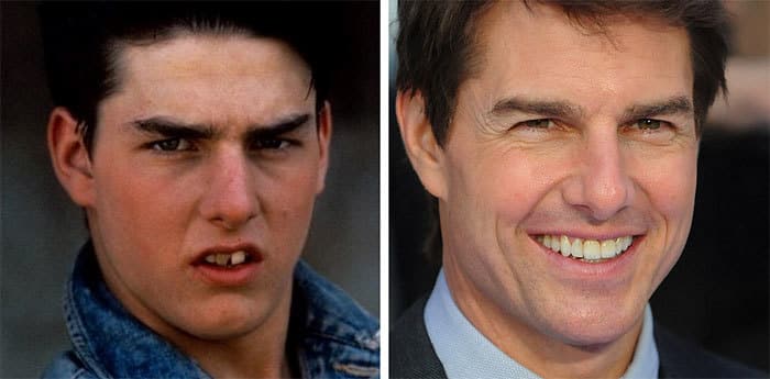 tomcruise