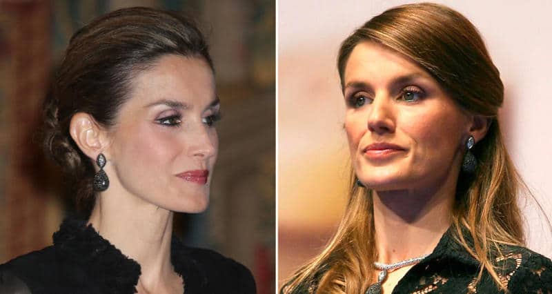 ¿Cuántas operaciones de estética se ha hecho la reina Letizia y cuánto dinero le han costado?