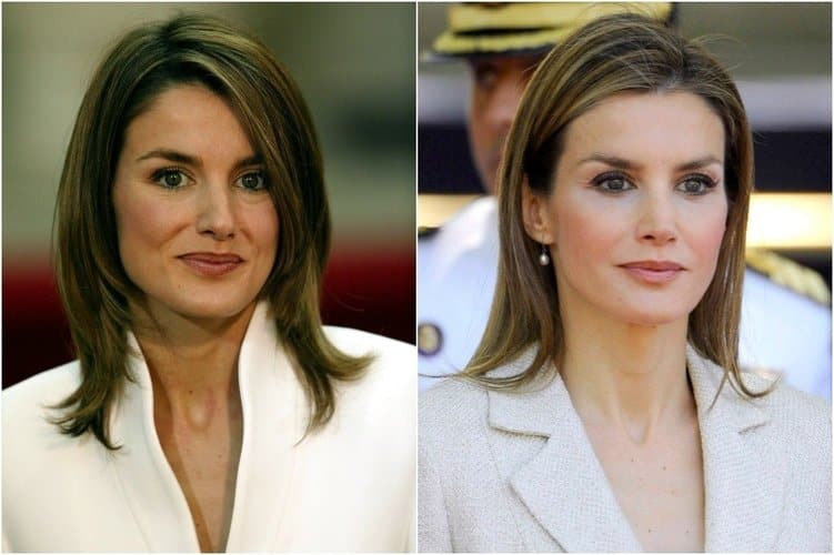 ¿Cuántas operaciones de estética se ha hecho la reina Letizia y cuánto dinero le han costado?