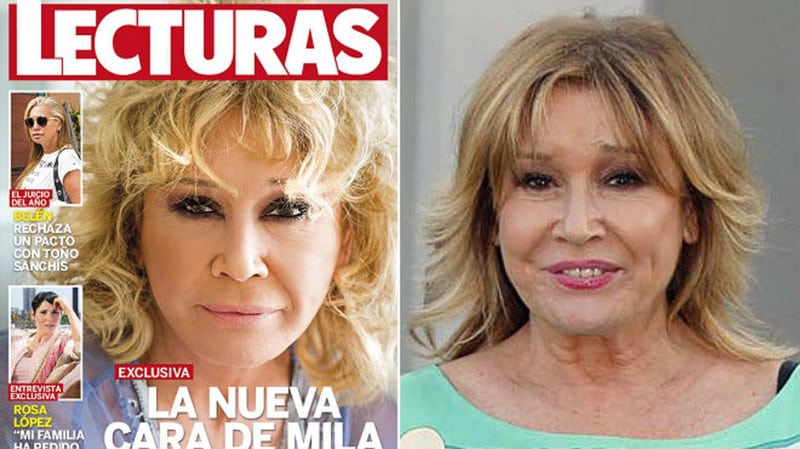 ¿Y tú quién eres? Famosos que se han operado (mucho) y ahora parecen otros