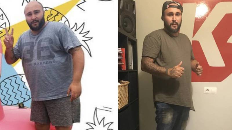 ¿Y tú quién eres? Famosos que se han operado (mucho) y ahora parecen otros