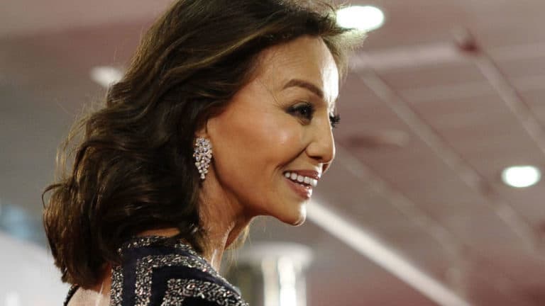 ¿Y tú quién eres? Famosos que se han operado (mucho) y ahora parecen otros