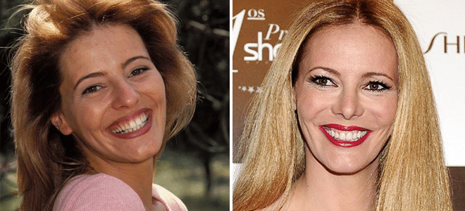Celebrities que han logrado un rotundo éxito profesional tras someterse a una rinoplastia