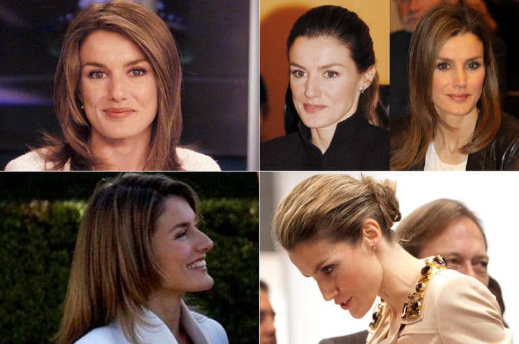 Entre las reinas del bisturí, Letizia es la líder (pero no la única)