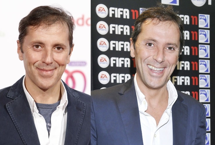 Joaquín Prat y otros famosos a los que les creció pelo por arte de magia