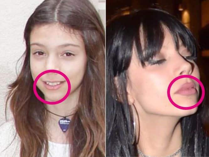 Se ha obrado el milagro: las fotos que confirman la transformación física de la hija de Terelu Campos