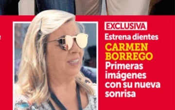 Carmen Borrego se opera los dientes, su antes y después