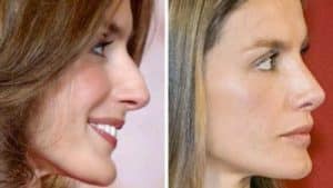 Doña Letizia, una reina maniática y obsesionada con doña Sofía