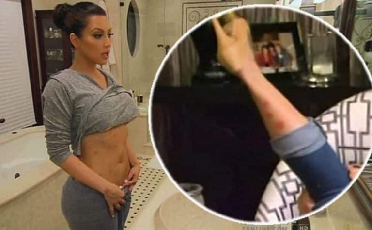 Kim Kardashian y otras famosas con enfermedades en la piel que las ocultan de escándalo. !Viva el maquillaje!