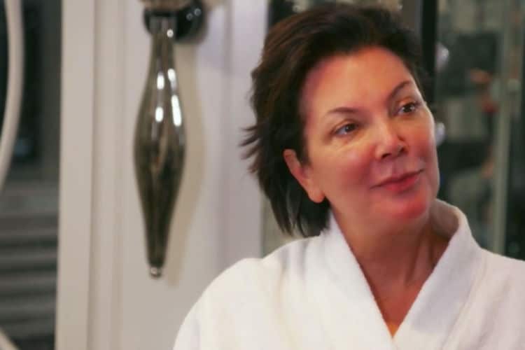 Kris Jenner también tiene psoriasis.