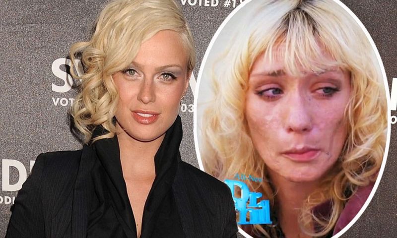 CariDee English con psoriasis.