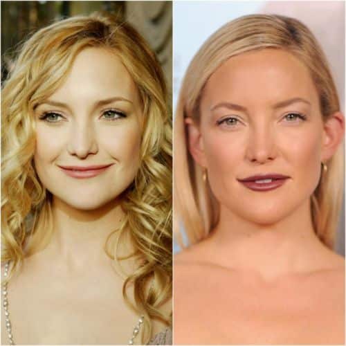 Kate Hudson.