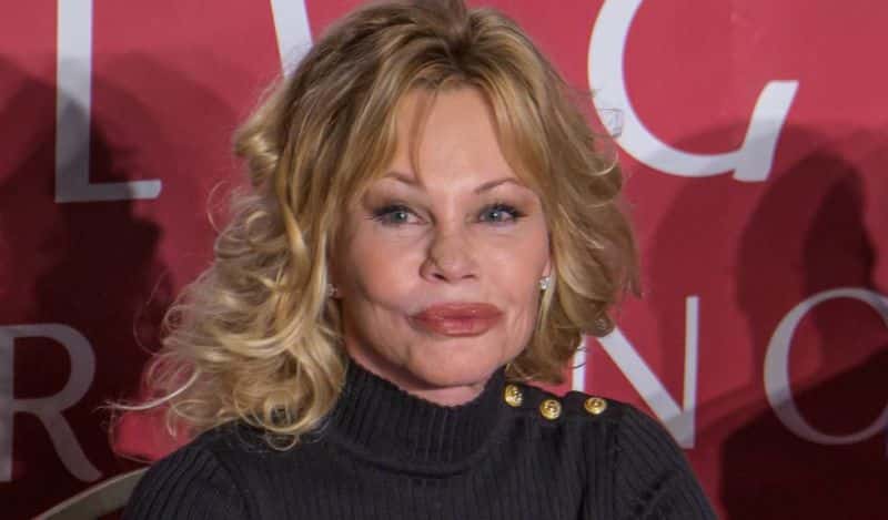 Melanie Griffith tuvo cáncer en la piel.