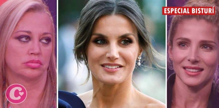 Famosos con retoques estéticos asombrosos y la reina Letizia se lleva el podio