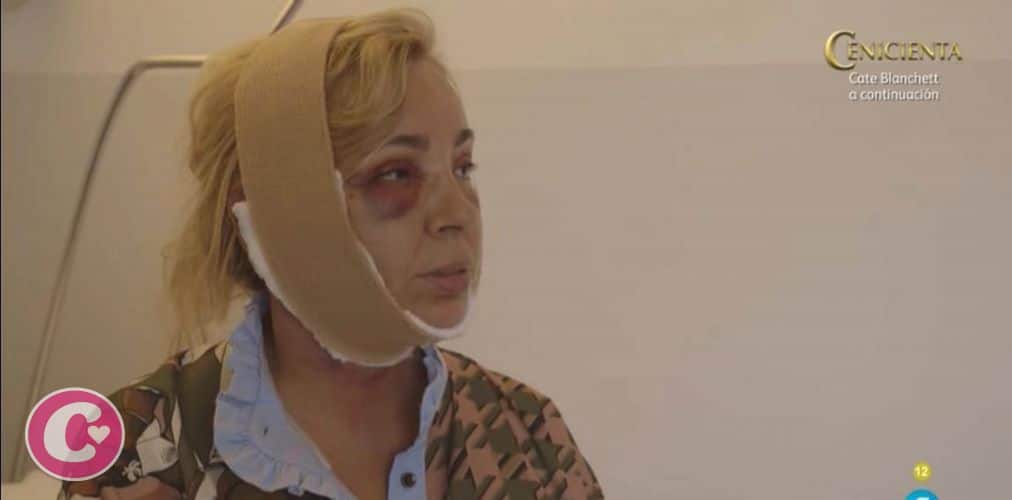 Alerta bótox: Estos son los cirujanos que operan a nuestros famosos
