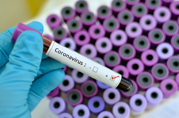 Última Hora: Cómo sobrevivir al CoronaVirus
