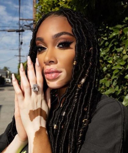 Winnie Harlow