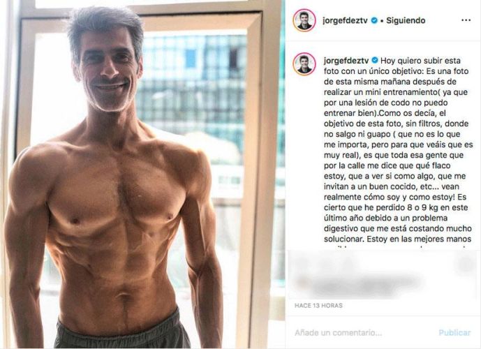 La dura enfermedad de Jorge Fernández que casi acaba con él