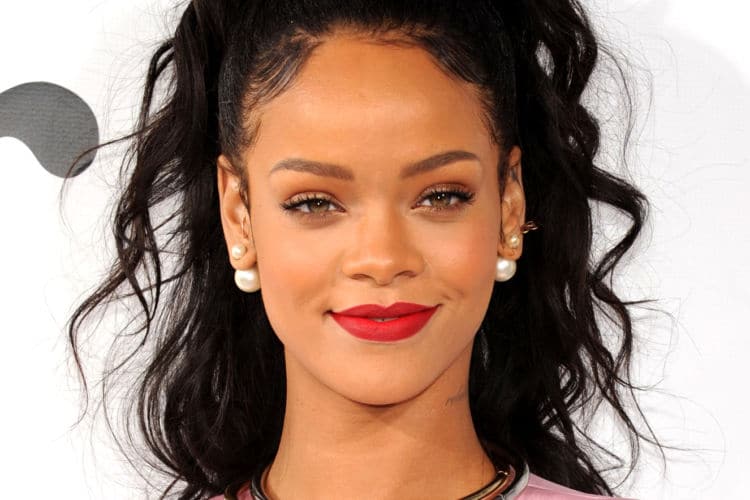 La insólita imagen de Rihanna llena de moretones por su accidente