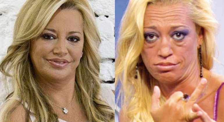 Paula Vázquez y otras famosas que se han ‘destrozado’ la cara