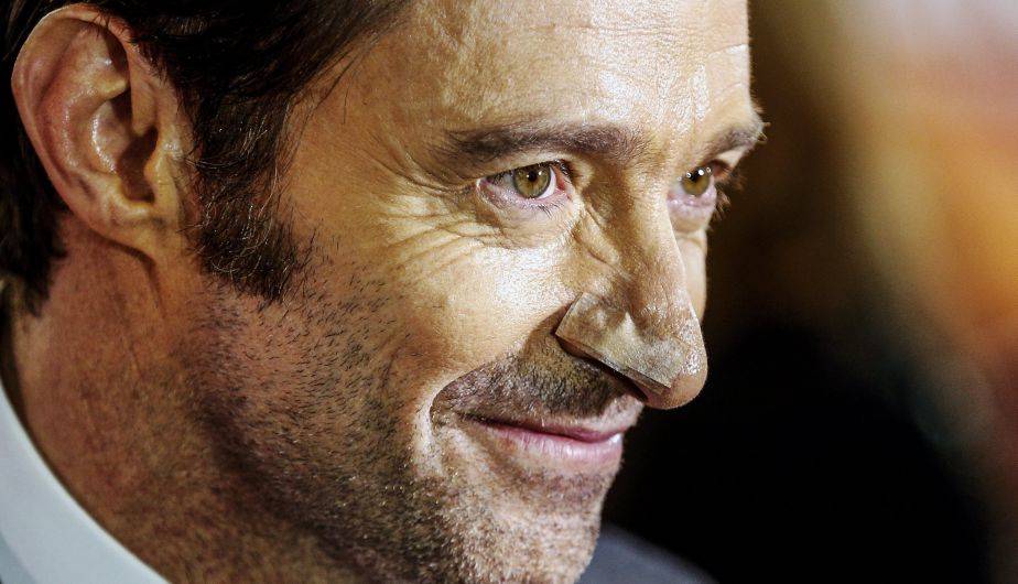 Hugh Jackman tuvo cáncer de piel