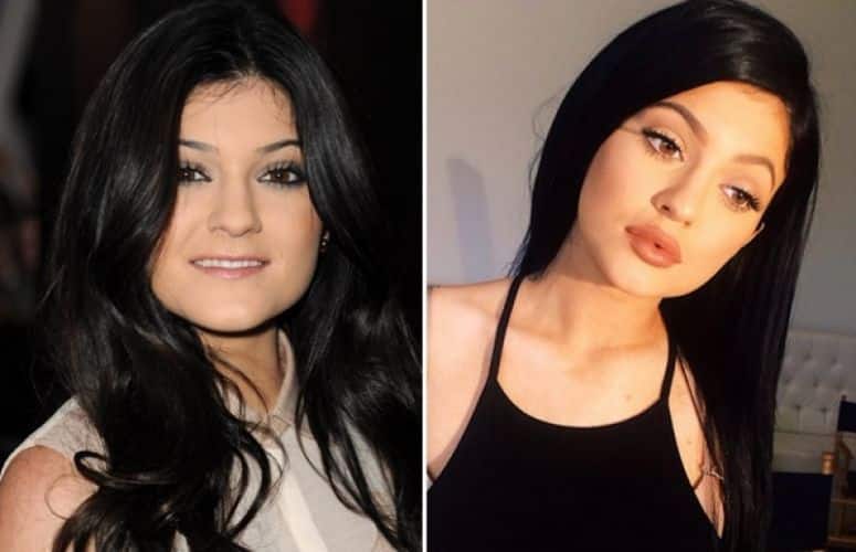 Kylie Jenner
