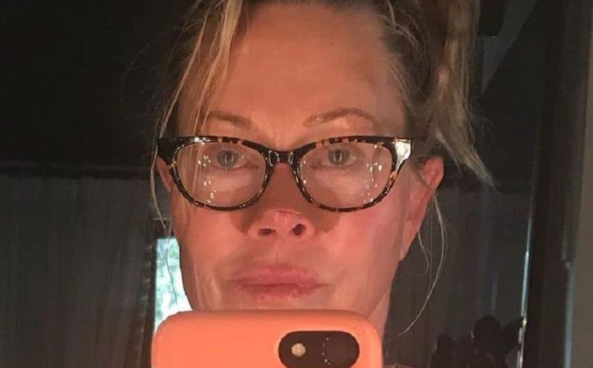 Melani Griffith cáncer de piel 