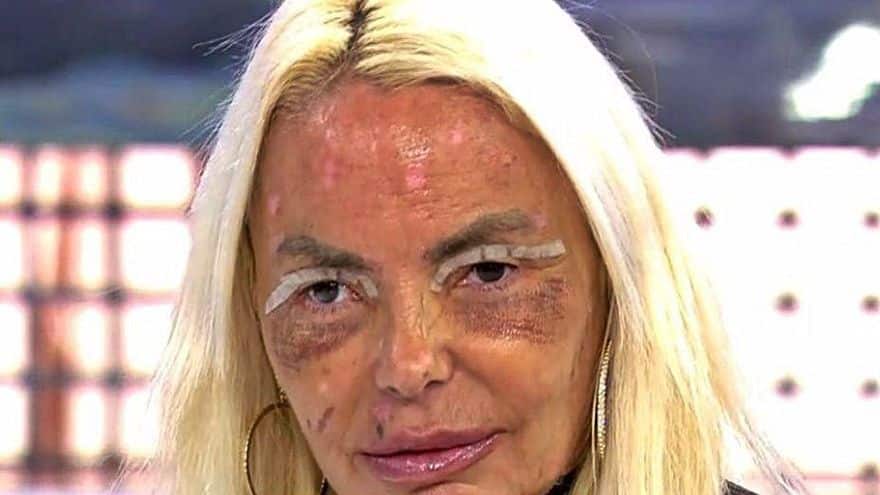Leticia párpados