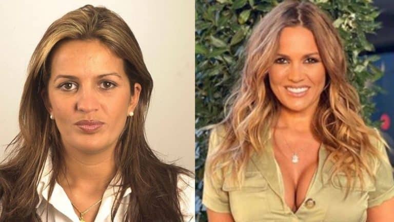 El tremendo dineral que se ha dejado Marta López en retoques al descubierto