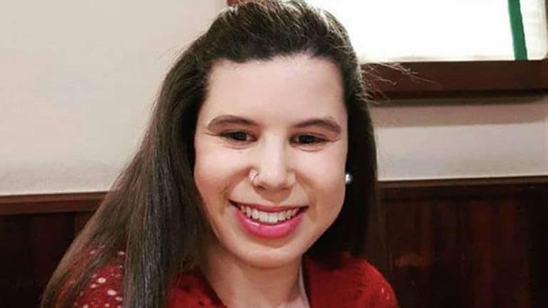 La mala pata de Carla Vigo: su pequeño accidente en un pie