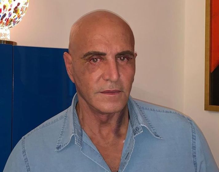 Kiko Matamoros y su cambio físico: Las redes se burlan de sus retoquitos