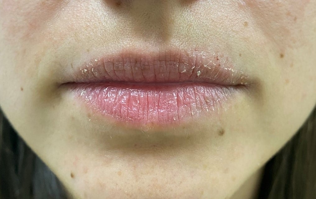 Trucos caseros para que tus labios no se estropeen con el frío