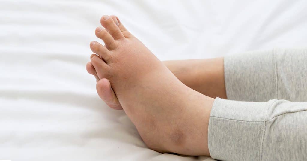 Estas son las 7 alertas que te manda tu cuerpo cuando va mal la circulación