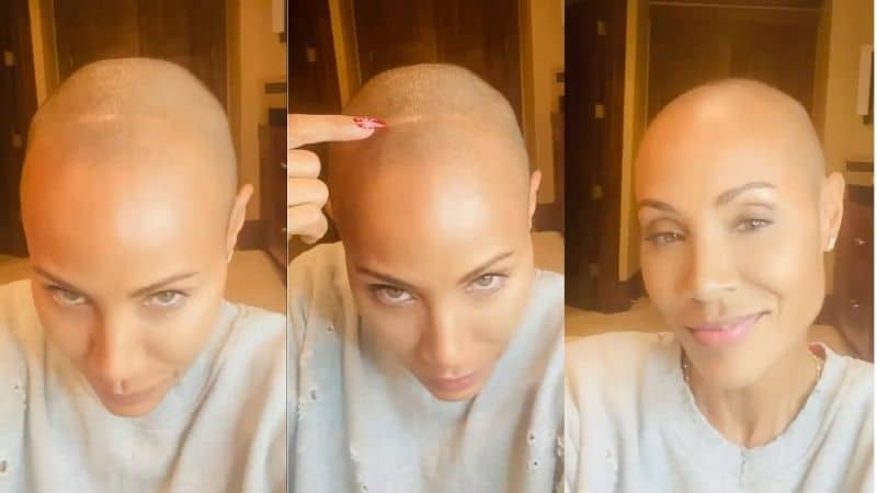 Jada Pinkett Smith - Alopecia Instagram