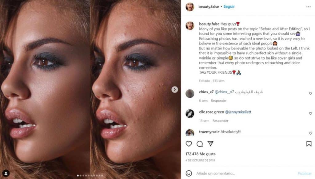 Instagram y rostros de las famosas con imperfecciones