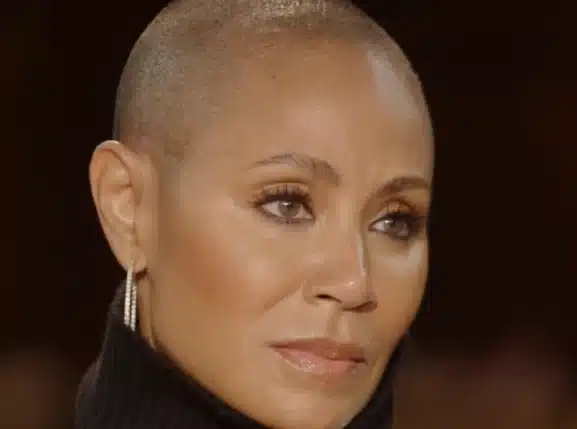 La actriz española que sufre el mismo problema que la mujer de Will Smith