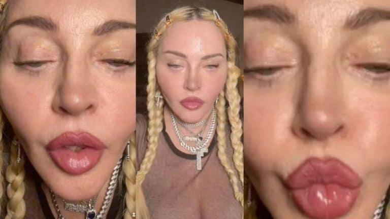 Todo el mundo se burla de Madonna y su cara: «Cuidado que me han dicho que es de goma»