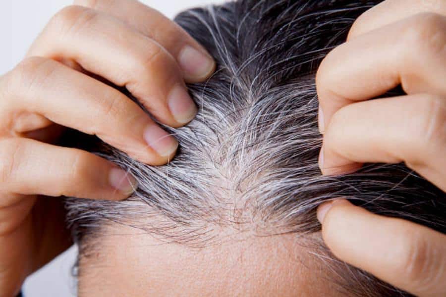 ¿Por qué salen las canas?