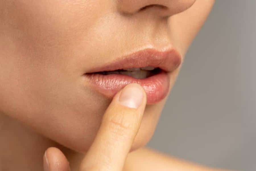 Principales signos del envejecimiento en los labios