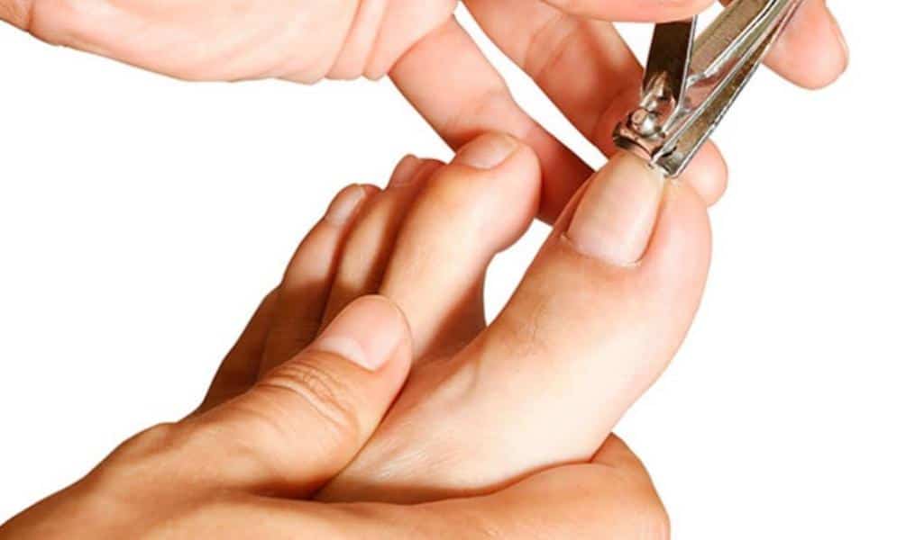 Cómo quitar las manchas negras en las uñas