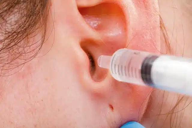 lavagem de ouvido 29696 l El truco para limpiar tus oídos sin utilizar bastoncillos