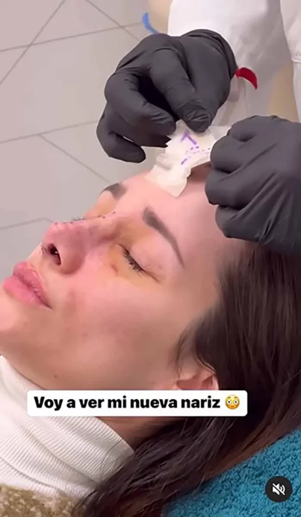 El antes y el después de Adara Molinero tras sus retoques estéticos
