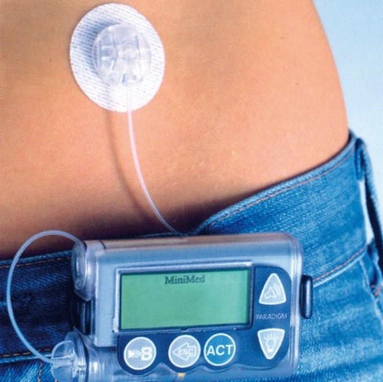 Mitos y verdades sobre la diabetes que debes de conocer Mitos y verdades sobre la diabetes que debes de conocer