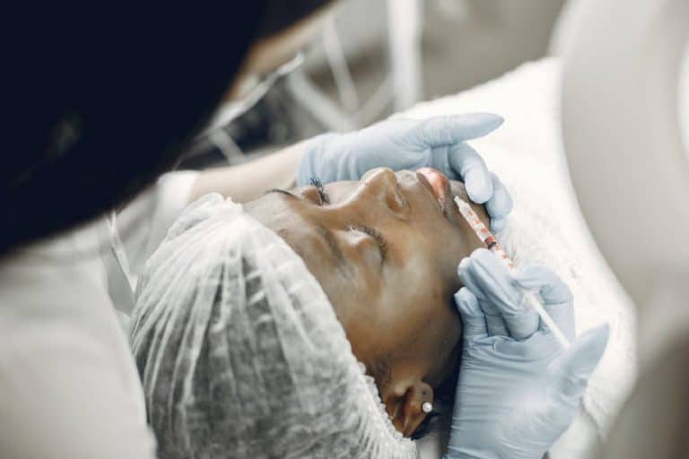 ¿Cuánto dura el ácido hialurónico en los labios?