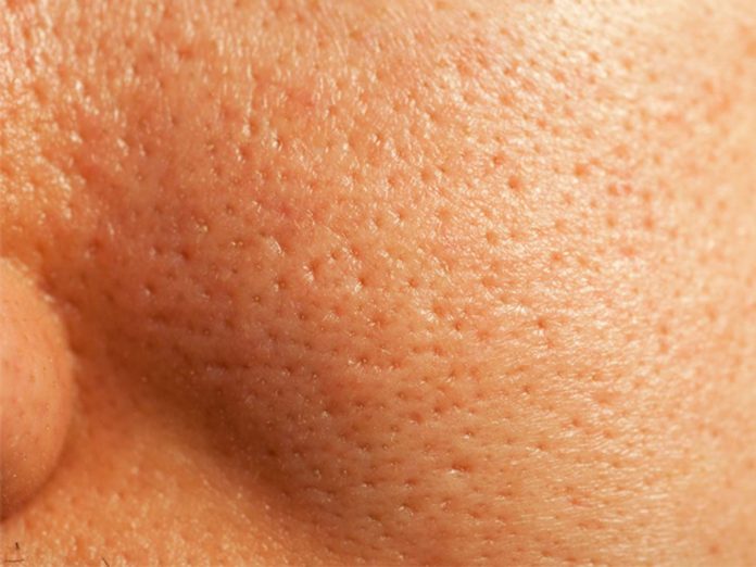 Poros dilatados: 8 Consejos de oro para una piel suave y radiante